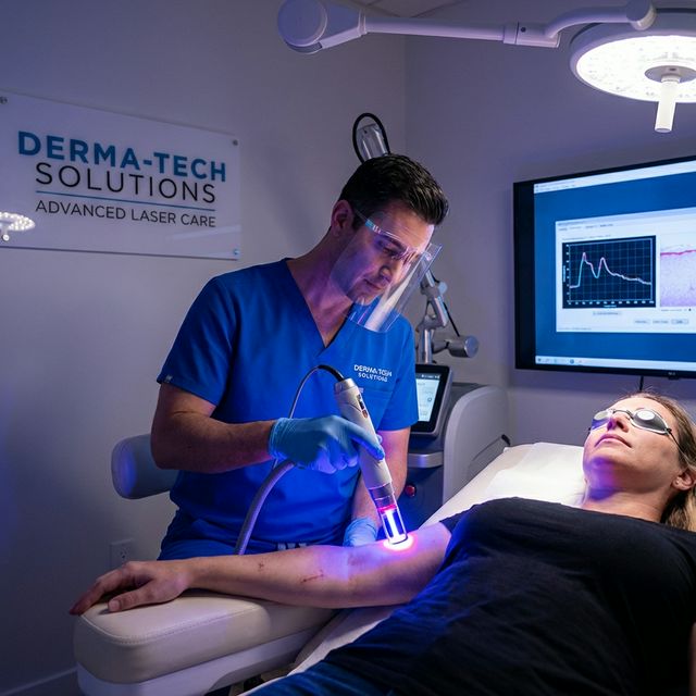 Tratamento para cicatrizes